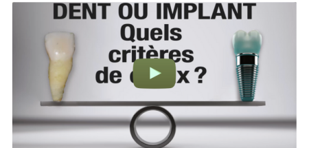 Traitement du secteur antérieur : dent ou implant